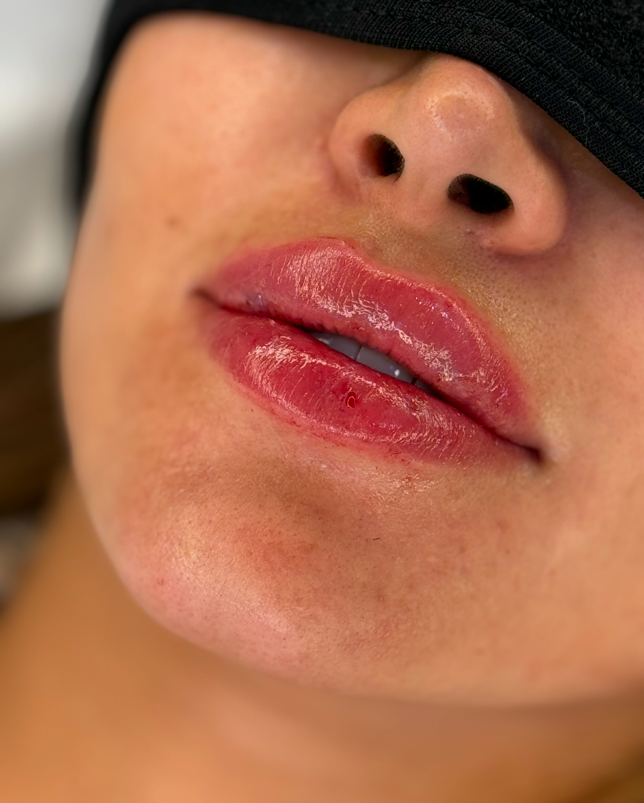 Lévia Lips